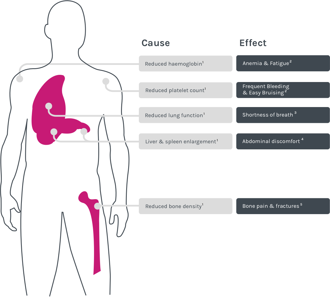 Gaucher Disease Symptoms Infographic